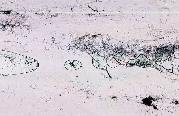 undefined3. Gradual Dose Reduction:</strong>