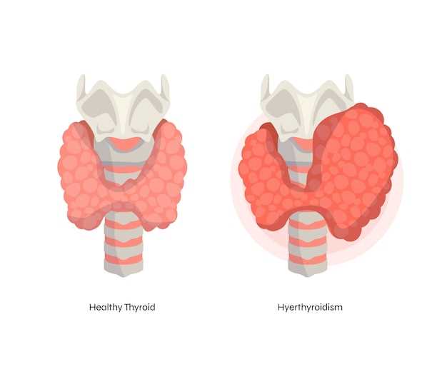 Armour thyroid conversion from levothyroxine