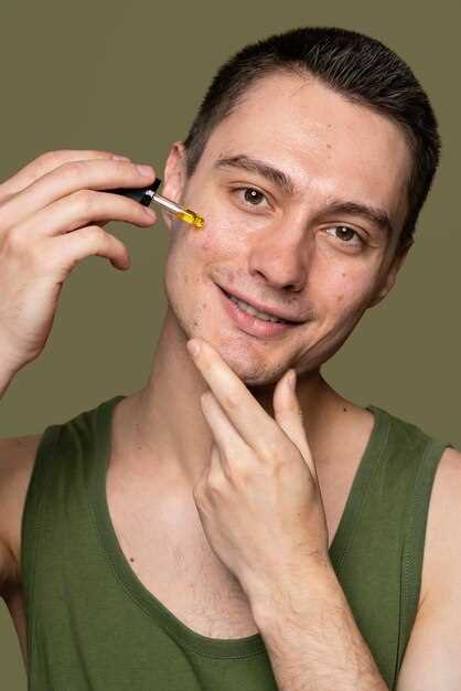 Finasteride 5 mg acne