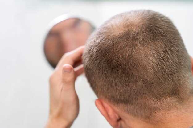 Preventing Hair Loss