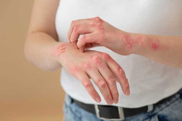 5. Avoid irritants:
