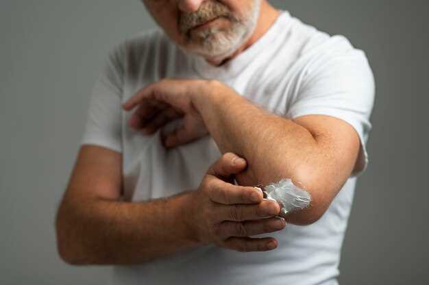 Tips for Avoiding Rashes