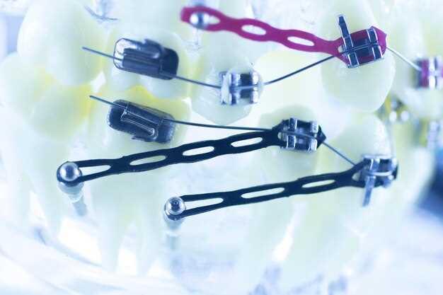 Lamictal and Seroquel Combination: A Promising Treatment Option